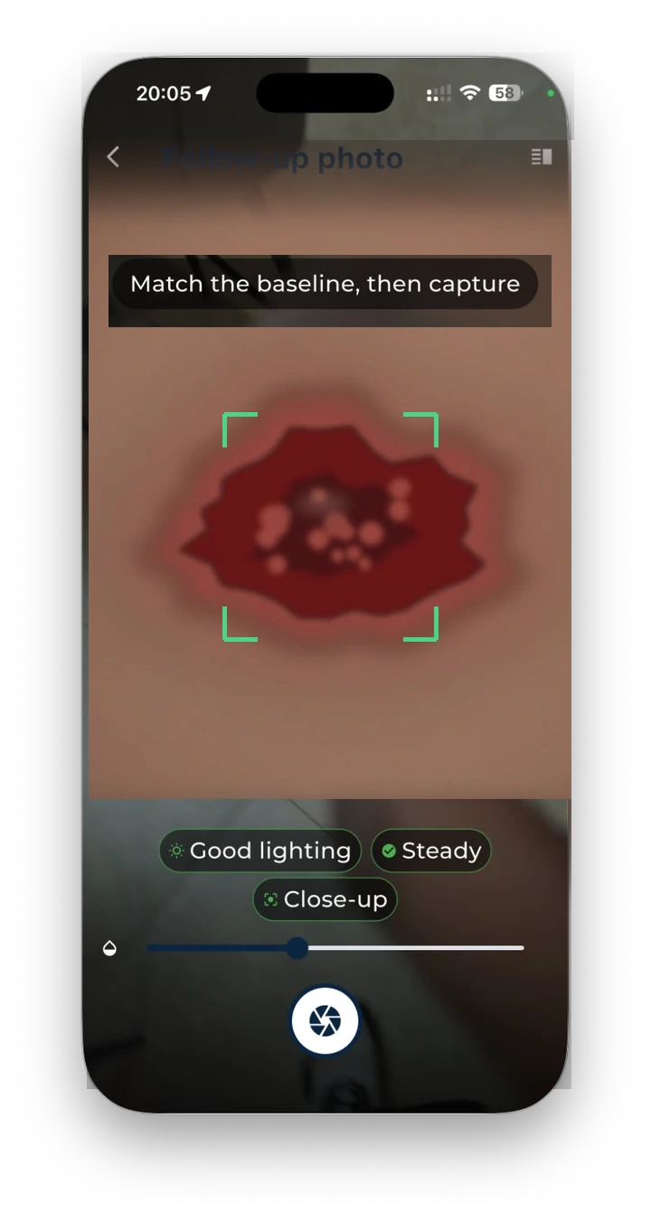 On-screen capture guidance