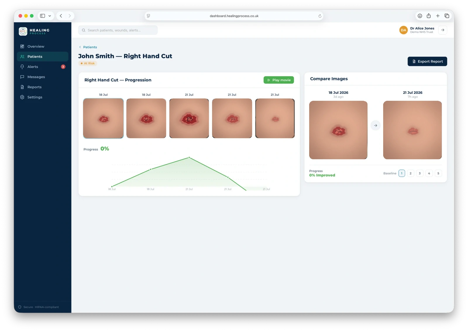 Progression view